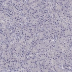 Immunohistochemical staining of human pancreas shows no positivity in exocrine glandular cells as expected.
