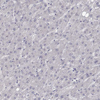 Anti-SLC6A3 Antibody