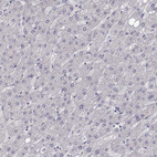Immunohistochemical staining of human liver shows no positivity in hepatocytes as expected.