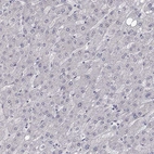 Immunohistochemical staining of human liver shows no positivity in hepatocytes as expected.