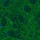 Anti-SLC6A3 Antibody