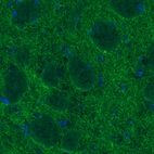 Immunohistochemical staining of rat striatum shows strong immunoreactivity in dopaminergic fibers.