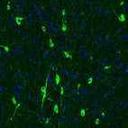 Immunofluorescence staining of rat brain shows strong cytoplasmic positivity in acetylcholine neurons in the medial septum.