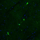 Immunofluorescence staining of mouse basal forebrain shows strong positivity in acetylcholine neurons in the caudate putamen.