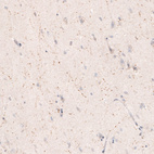 Immunohistochemical staining of human cerebral cortex shows positivity in cholinergic neural fibers.