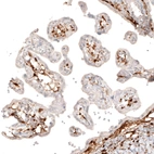 Immunohistochemical staining of human placenta shows strong cytoplasmic positivity in a subset of cells in chorionic villi.