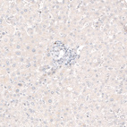 Immunohistochemical staining of human liver shows no positivity in hepatocytes as expected.