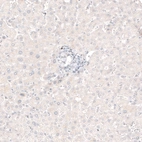Immunohistochemical staining of human liver shows no positivity in hepatocytes as expected.