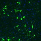 Immunofluorescence staining of rat brain shows strong positivity in acetylcholine neurons in the basal forebrain.