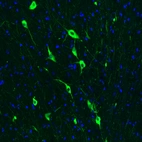 Immunofluorescence staining of rat brain shows strong positivity in acetylcholine neurons in the medial septum.