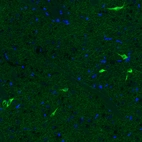 Immunofluorescence staining of mouse basal forebrain shows strong positivity in acetylcholine neurons in the caudate putamen.