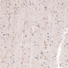 Immunohistochemical staining of human cerebral cortex shows moderate positivity in cholinergic neural fibers.