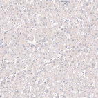 Immunohistochemical staining of human liver shows no positivity in hepatocytes as expected.