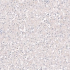 Immunohistochemical staining of human liver shows no positivity in hepatocytes as expected.