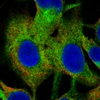 Immunofluorescence staining of SK-MEL-30 cells using the Anti-CHAT monoclonal antibody, showing specific staining in the cytosol in green. Microtubule- and nuclear probes are visualized in red and blue, respectively (where available).
