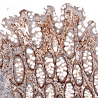 Immunohistochemical staining of human colon shows strong positivity in basement membrane of glandular cells.