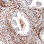 Immunohistochemical staining of human prostate shows moderate to strong membranous positivity in smooth muscle cells.