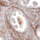 Anti-LAMA4 Antibody