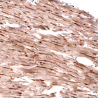 Immunohistochemical staining of rat heart muscle shows moderate to strong membranous positivity in cardiomyocytes.