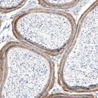 Immunohistochemical staining of mouse epididymis shows moderate to strong membranous positivity in smooth muscle cells.