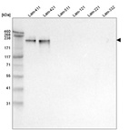 Western blot analysis of purified human recombinant Laminin-411, Laminin-421, Laminin-511, Laminin-121, Laminin-221 and Laminin-332.