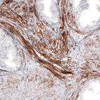 Anti-LAMA4 Antibody