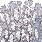 Immunohistochemical staining of human colon shows strong positivity in basement membrane of glandular cells.