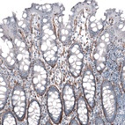 Anti-LAMA4 Antibody