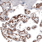 Immunohistochemical staining of human placenta shows strong membranous positivity in endothelial cells.