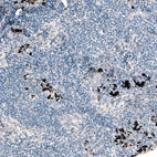 Immunohistochemical staining of human lymph node shows no positivity in lymphoid cells as expected.