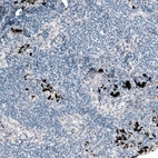 Immunohistochemical staining of human lymph node shows no positivity in lymphoid cells as expected.