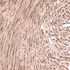 Immunohistochemical staining of mouse heart muscle shows strong membranous positivity in cardiomyocytes.