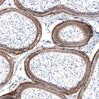 Immunohistochemical staining of mouse epididymis shows strong membranous positivity in smooth muscle cells.