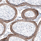Immunohistochemical staining of mouse epididymis shows strong membranous positivity in smooth muscle cells.