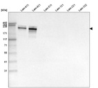 Western blot analysis of purified human recombinant Laminin-411, Laminin-421, Laminin-511, Laminin-121, Laminin-221 and Laminin-332.