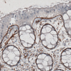 Anti-LAMC1 Antibody