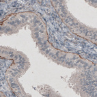 Immunohistochemical staining of human fallopian tube shows strong positivity in basement membrane of glandular epithelium.