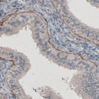 Anti-LAMC1 Antibody