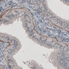Immunohistochemical staining of human fallopian tube shows strong positivity in basement membrane of glandular epithelium.