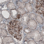 Immunohistochemical staining of human kidney shows strong immunoreactivity in basement membrane of renal tubules and membranous positivity in glomeruli.