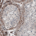 Immunohistochemical staining of human testis shows strong positivity in basement membrane in seminiferous tubules.