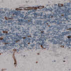 Anti-LAMC1 Antibody