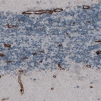 Immunohistochemical staining of human cerebellum shows strong immunoreactivity in endothelium.