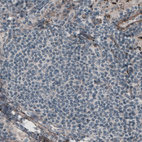 Anti-LAMC1 Antibody