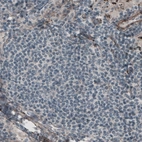 Immunohistochemical staining of human lymph node shows absence of immunoreactivity in lymphoid cells (negative control).