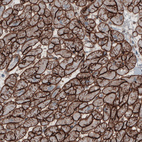 Anti-LAMC1 Antibody