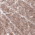 Immunohistochemical staining of human heart muscle shows strong positivity in basement membrane of cardiomyocytes.