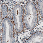 Immunohistochemical staining of human endometrium shows strong positivity in basement membrane of glandular epithelium.