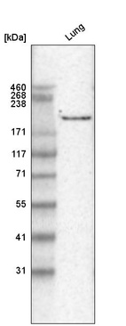Western blot analysis in human lung tissue.
