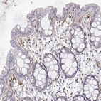 Immunohistochemical staining of human rectum shows moderate positivity in basement membrane of glandular cells.